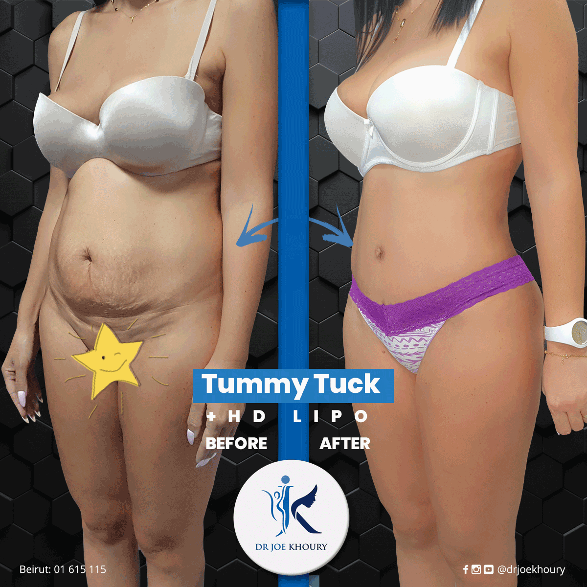 tummy-copy